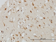 H00005274-M01 - Neuroserpin / SERPINI1