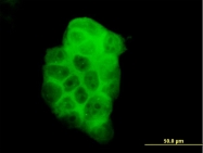 H00005287-M02 - PIK3C2B