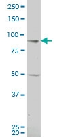 H00005317-A01 - Plakophilin 1 / PKP1