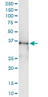 H00005413-D01 - Septin-5 (SEPT5)