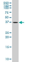 H00005423-A01 - DNA polymerase beta