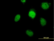 H00005423-B01P - DNA polymerase beta