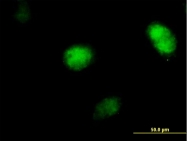 H00005429-B01P - POLH / RAD30