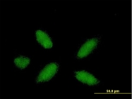 H00005465-B01P - PPAR-alpha