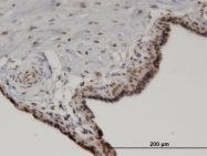 H00005494-M03 - Protein phosphatase 1A / PPM1A