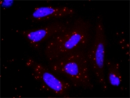 H00005494-M03 - Protein phosphatase 1A / PPM1A