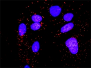 H00005495-D01P - Protein phosphatase 1B / PPM1B
