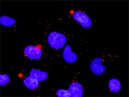 H00005495-M01 - Protein phosphatase 1B / PPM1B
