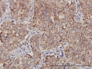 H00005498-M01 - PPOX