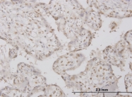 H00005504-M01 - PPP1R2 / IPP2