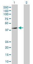H00005564-D01P - AMPK beta-1 chain / AMPKb