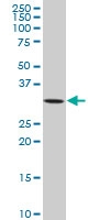 H00005565-A01 - AMPK beta-2 chain / PRKAB2
