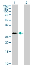 H00005565-D01P - AMPK beta-2 chain / PRKAB2
