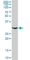 H00005565-D01P - AMPK beta-2 chain / PRKAB2