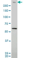 H00005591-M03 - DNA-PKcs / PRKDC / XRCC7