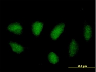 H00005600-B01 - MAP kinase p38 beta / MAPK11