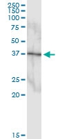 H00005600-D01 - MAP kinase p38 beta / MAPK11