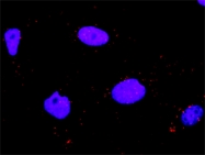 H00005600-D01P - MAP kinase p38 beta / MAPK11