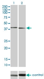 H00005600-M03 - MAP kinase p38 beta / MAPK11