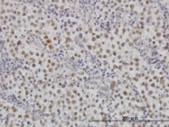 H00005606-M02 - MAP2K3