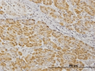 H00005609-M04 - MAP2K7