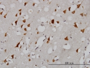 H00005610-M01 - EIF2AK2 / PKR