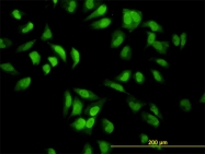 H00005610-M01 - EIF2AK2 / PKR