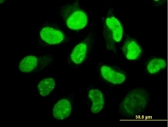 H00005610-M02 - EIF2AK2 / PKR