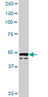 H00005612-B01P - Death-associated protein 4