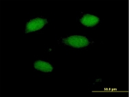 H00005612-B01P - Death-associated protein 4