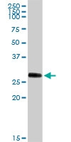 H00005644-D01P - Trypsin-1 / PRSS1