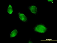 H00005655-B01P - KLK10 / Kallikrein-10