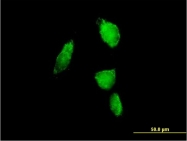 H00005687-B01P - PSMA6