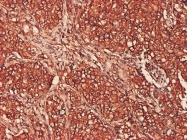 H00005688-M01 - PSMA7