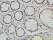 H00005688-M01 - PSMA7