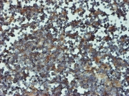 H00005694-M01 - PSMB6