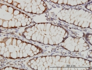 H00005704-M01 - PSMC4 / TBP7