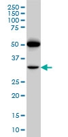 H00005739-M01 - Prostacyclin receptor / PTGIR