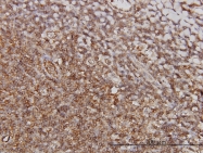 H00005739-M01 - Prostacyclin receptor / PTGIR