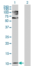 H00005741-D01P - Parathyroid hormone / PTH