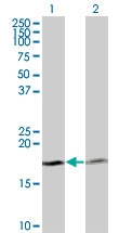 H00005741-M12 - Parathyroid hormone / PTH