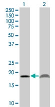 H00005741-M15 - Parathyroid hormone / PTH