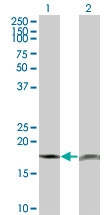 H00005741-M18 - Parathyroid hormone / PTH