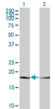 H00005741-M19 - Parathyroid hormone / PTH
