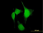H00005743-B01P - Cyclooxygenase 2
