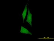 H00005753-B01P - PTK6 / BRK