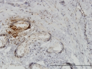 H00005756-M02 - Twinfilin-1 (TWF1)