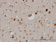 H00005764-M01 - Pleiotrophin / PTN