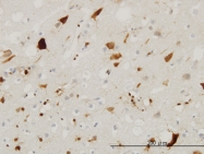 H00005764-M02 - Pleiotrophin / PTN