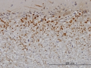 H00005764-M03 - Pleiotrophin / PTN